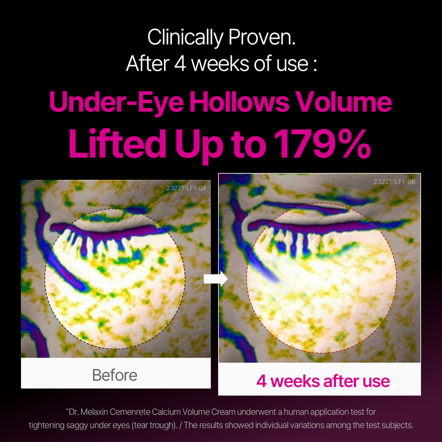 Cemenrete Calcium Multi Balm 9g