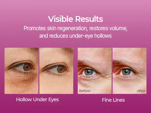 Cemenrete Calcium Multi Balm 9g