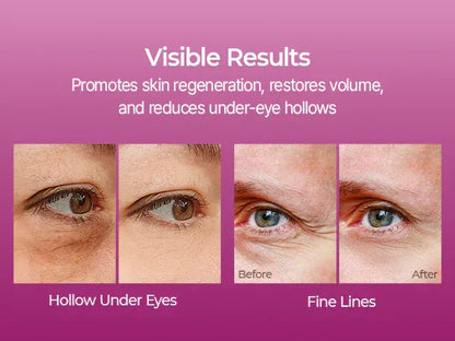 Cemenrete Calcium Multi Balm 9g